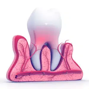 Tooth Extraction Before Dental Implant Surgery